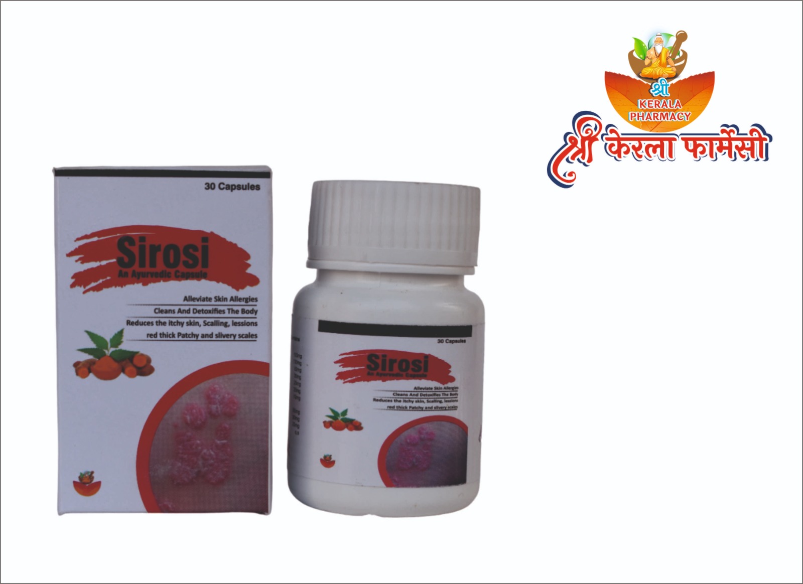 Psoriasis, Itchy, Dry Patches